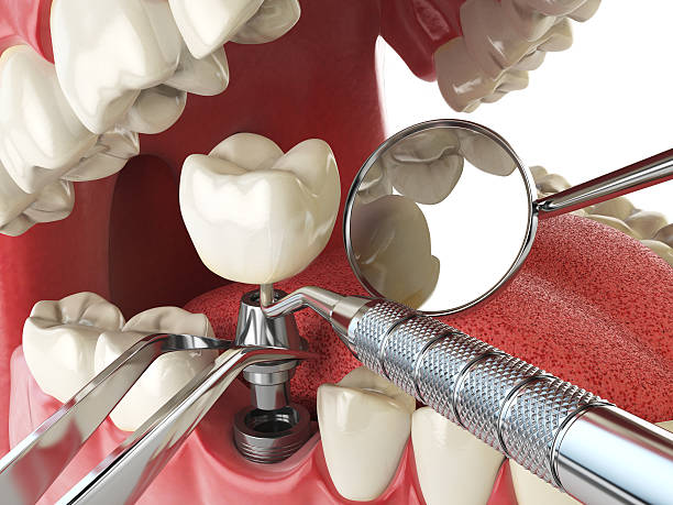 Best Pediatric Emergency Dentist in Aitkin, MN